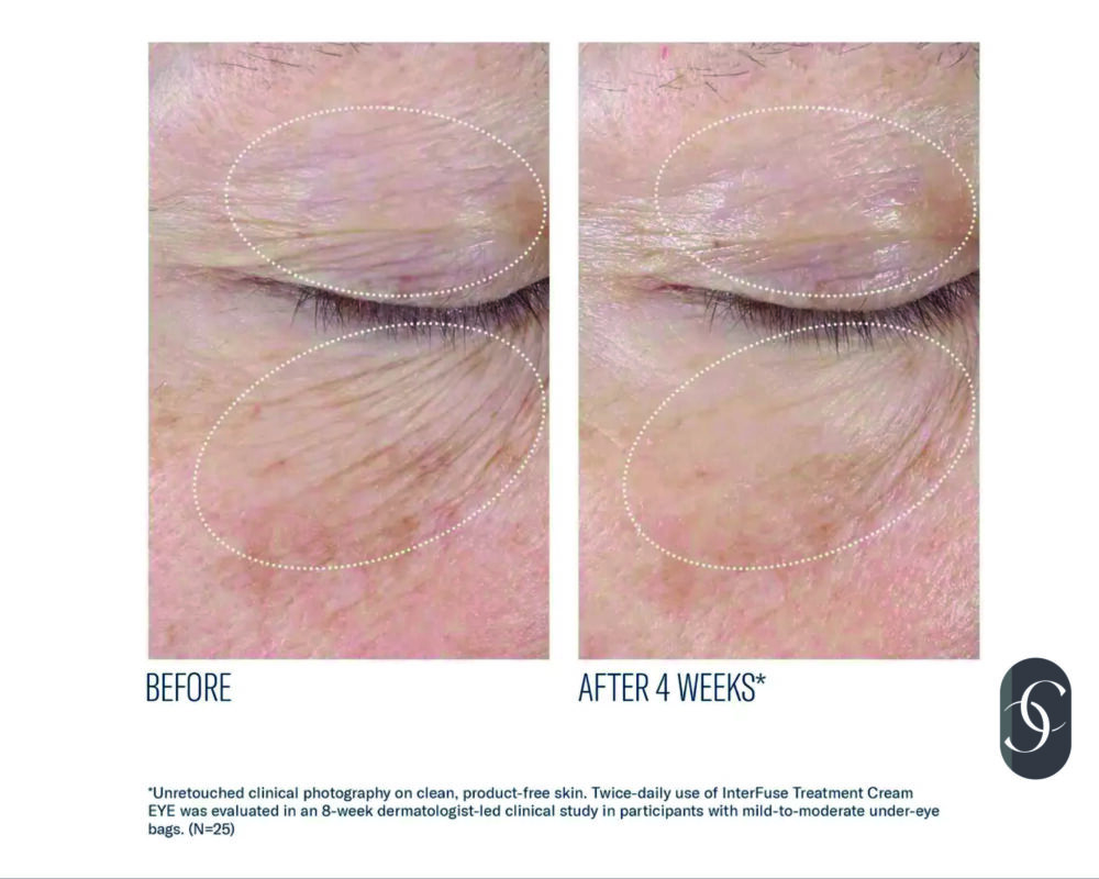 Interfuse Treatment Cream Eye