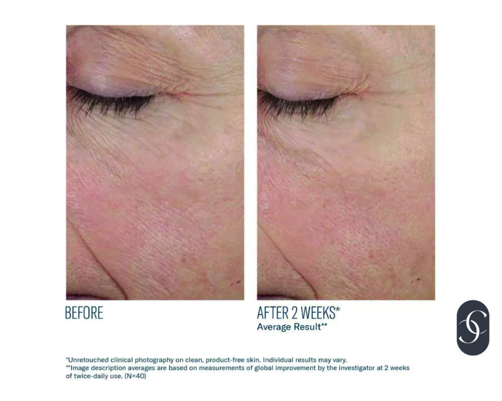 Trio Rebalancing Moisture Treatment