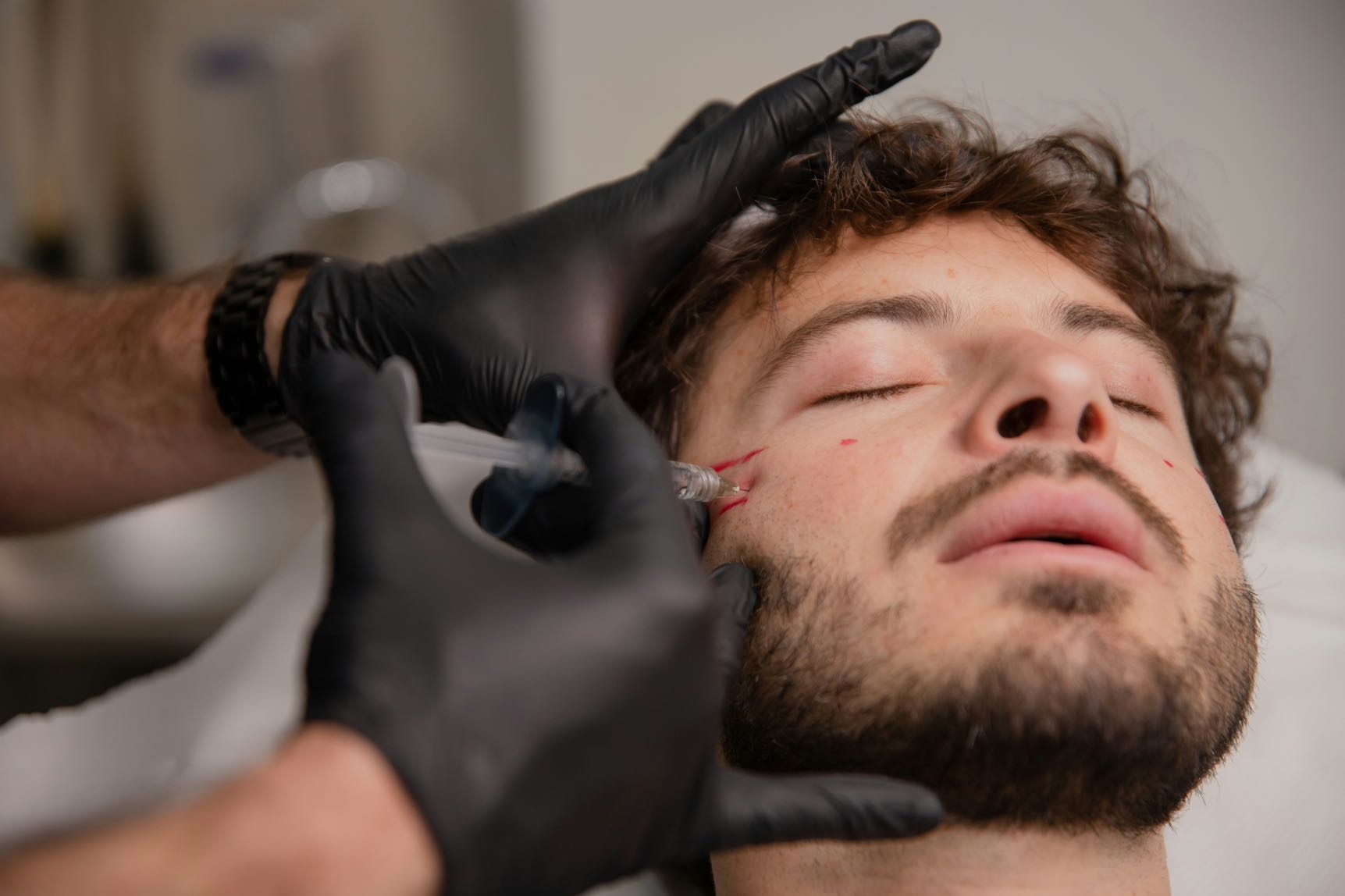 Male receiving filler injections in Sydney