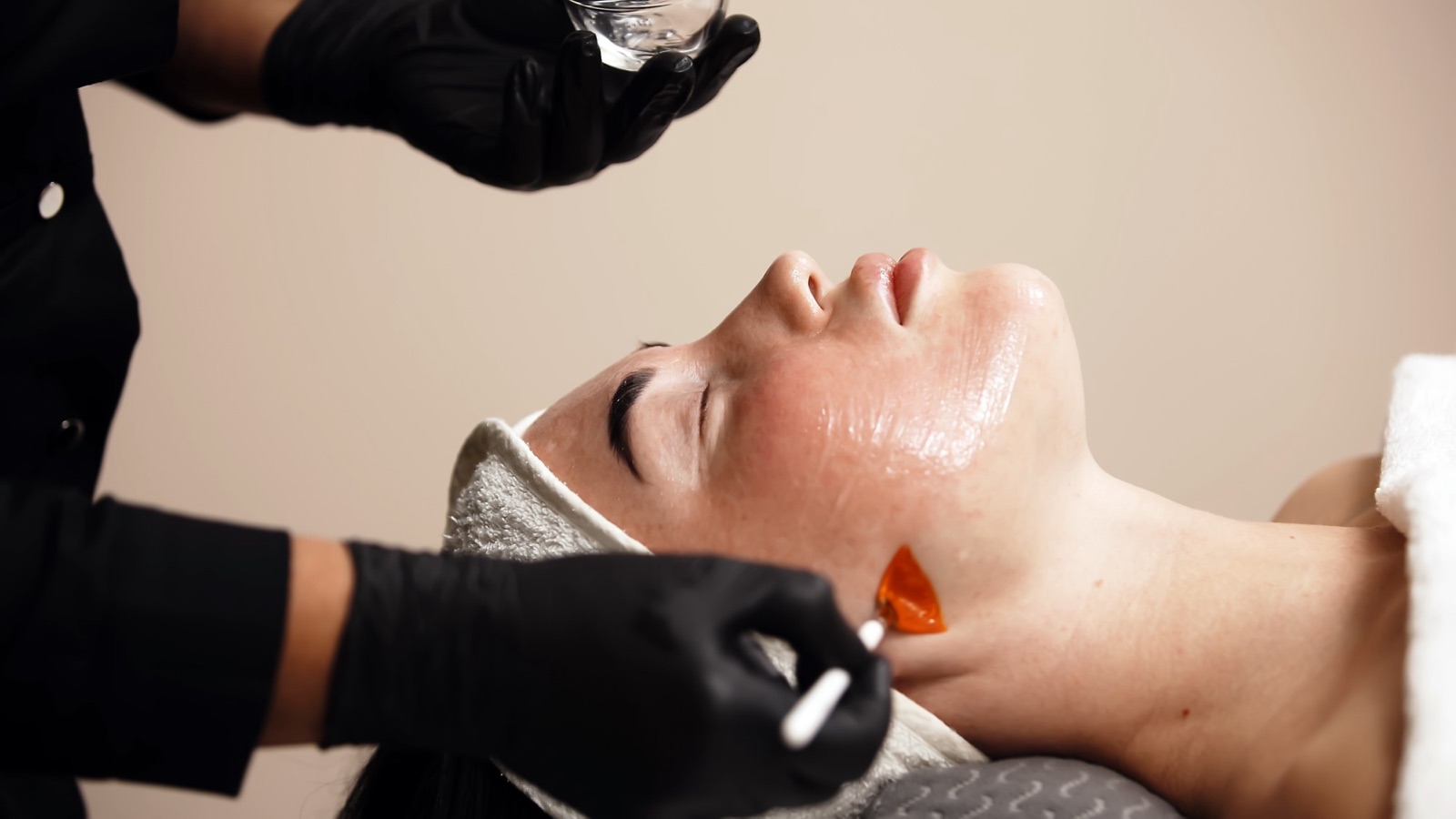 Gloved hands brushing an orange chemical peel onto a woman&rsquo;s neck as she lies back with her eyes closed, her face already glossy from the peel