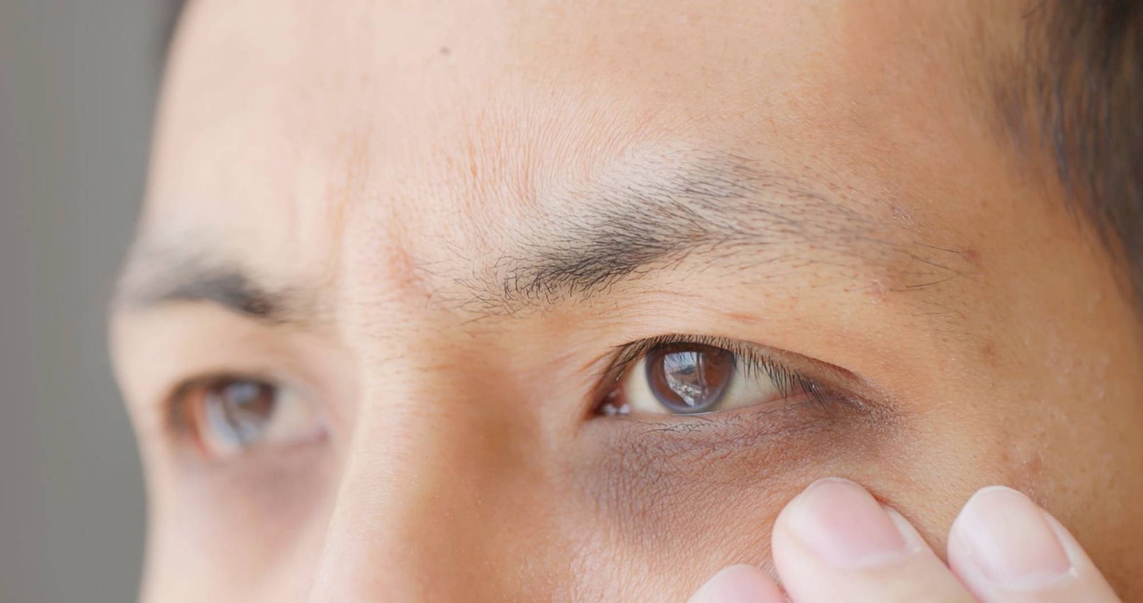 Close-up of a man's eyes with tired-looking skin and shadows beneath them