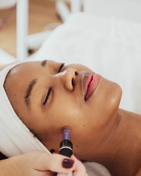Texture and pores