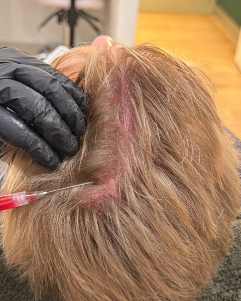 Diffuse thinning