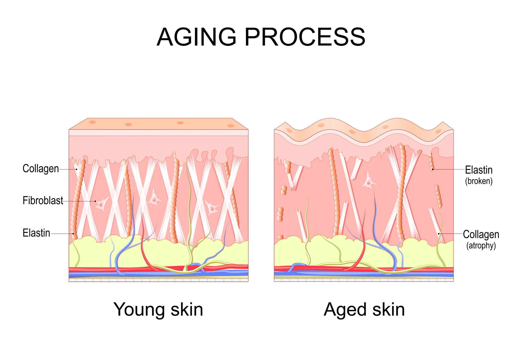 Diagram comparing young and aged skin: dense collagen and elastin fibres with fibroblasts in young skin, broken elastin and thinning collagen in aged skin
